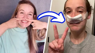 Doctors LIE! Post-Op Recovery...*10 Days After Sinus Surgery*