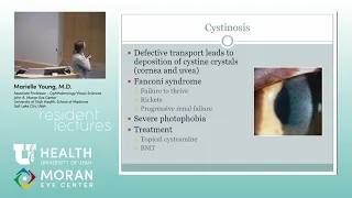 Pediatric Anterior Segment Disorders