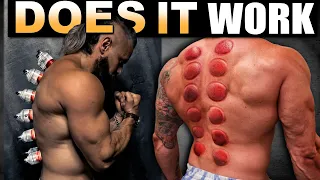 The WORST PAIN ❗️ Testing CUPPING THERAPY On Raw BACK/SPINAL INJURY (Does it Really Work?!)