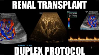 Renal/Kidney Transplant Duplex Protocol