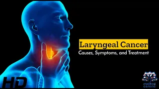 Laryngeal Cancer: Silent Struggles and Hopeful Treatments