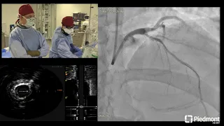 Coronary Live Case for SCAI Scientific Sessions