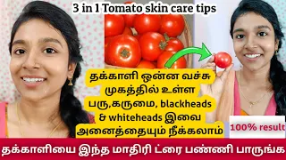 3 in 1/pimples remedy/ skin brightening remedy/ Blackheads and whiteheads removal remedy/ 🍅 tomato 🍅