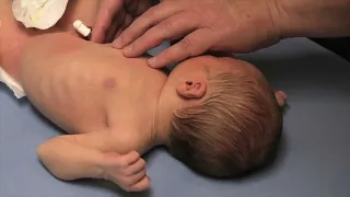 Abdominal Examination of the Newborn - Stanford Medicine