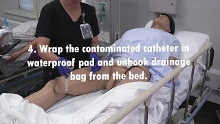 Removal of Urinary Catheter