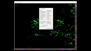 Part 6. Data (Image) Analysis: Image J to determine Area of Lipid Droplets