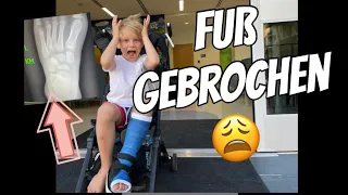 Milan hat seinen Fuß gebrochen 😩