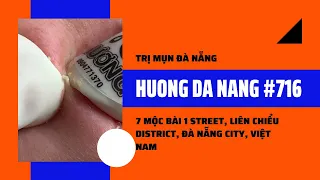 #176 | Huong Da Nang