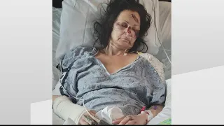 Mother of 3 carjacked, run over with her car, recovering in hospital