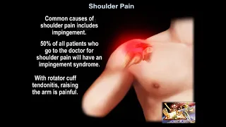 Shoulder Pain - Everything You Need To Know - Dr. Nabil Ebraheim