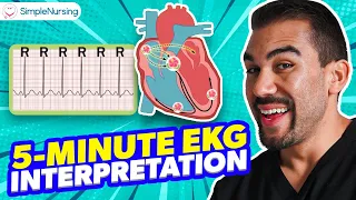 5 minute EKG/ECG Interpretation for NCLEX-RN - Simplenursing