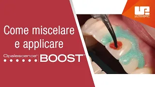 ULTRADENT -  Opalescence™ Boost™: come miscelare e applicare lo sbiancamento dentale medicale