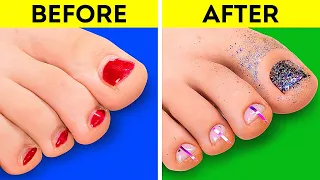 Amazing Pedicure Transformation || New Nail Design Ideas by 5-Minute DECOR!