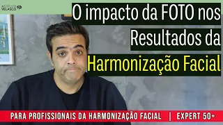 Como fazer Fotos de antes e depois para Harmonização Facial | Exp50+_EP_025