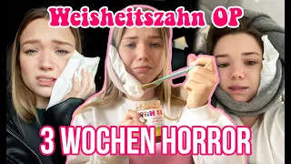 Meine Weisheitszahn OP AN WEIHNACHTEN und der extreme Horror danach