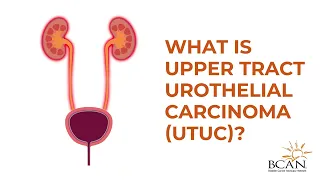 Upper Tract Urothelial Carcinoma | Bladder Cancer Advocacy Network