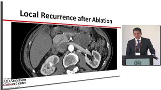 What are my options if my cancer comes back in my kidney?