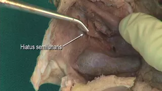 1.11 Step 6.  Lateral wall of the nasal cavity