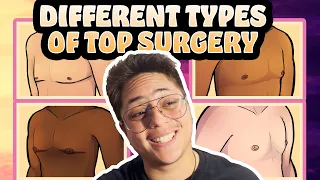 What Are the Different Types of Top Surgery Procedures? | Trans FTM | FTN (ft educational graphics)