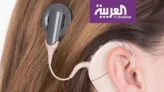 صباح العربية | زراعة القوقعة تعيد الأمل للطفلة السعودية لمار