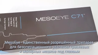 Безоперационное удаление грыжевых мешков под глазами в Центре инновационной косметологии ALTEOS