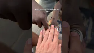 $0.12 street pedicure in Lagos, Nigeria