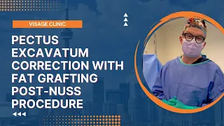 Pectus Excavatum Correction with Fat Grafting Post-NUSS procedure | Visage Clinic Toronto