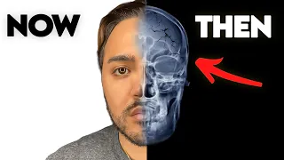 The TRUTH About My Brain Injury!