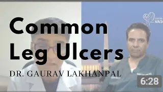 Leg Ulcers | Venous Leg Ulcers Symptoms and Treatment