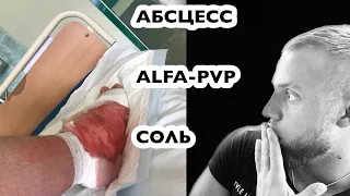 ALFA-PVP/ЖУТКИЙ ПЕРЕДОЗ/АБСЦЕСС ОТ СОЛЕЙ/ALFA-PVP/ЧУТЬ НЕ ОТРЕЗАЛИ НОГУ