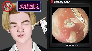 [ASMR] Tingle eardrum ! Cool ear cleaning animation / ear endoscope / ear cleaning animation asmr