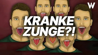 Braune Zunge, Erdbeerzunge, Lackzunge? DAS erfährst du über Deine Gesundheit!