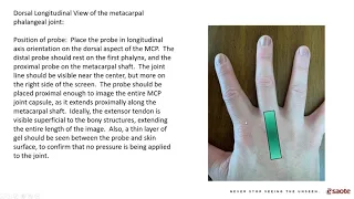 The Role of MSK Ultrasound in Rheumatology Clinical Practice (Hands and Wrists)