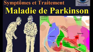 Maladie de parkinson physiopathologie du tremblement symptomes traitement maladie neurologique