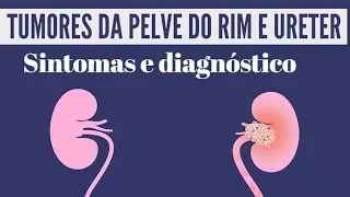 TUMORES DA PELVE DO RIM E URETER - SINTOMAS E DIAGNÓSTICO