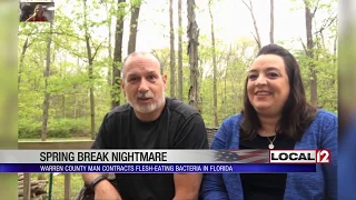 Warren County man contracts flesh-eating bacteria during trip to Florida