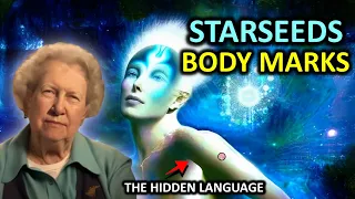 The Hidden Mysteries of 8 Starseeds Body Marks by✨ Dolores Cannon