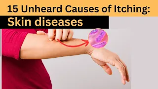 15 Unheard Causes of Itching: Unveiled