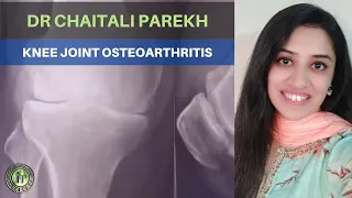 RADIOGRAPHY IN KNEE ARTHRITIS |  DR CHAITALI PAREKH | OSTEOARTHRITIS |