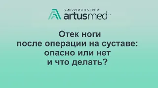 Отек после эндопротезирования сустава, мой личный пример. Причины и лечение и методы профилактики.