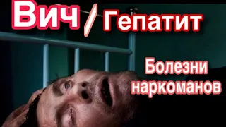 ВИЧ /Гепатит /БОЛЕЗНИ НАРКОМАНОВ /Безумие употребления наркотиков