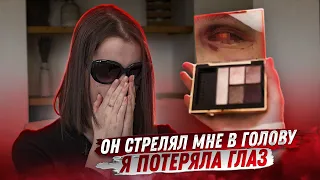 Мой парень выстрелил мне в голову, и я потеряла глаз / Miss X