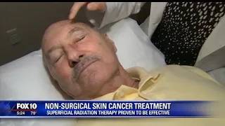 Non-Surgical Skin Cancer Treatment