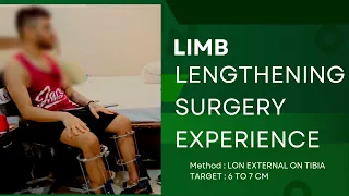 Limb Lengthening Surgery Patient's Experience. LON External Method on Tibia .  Dr. Amar Sarin