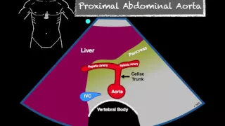 Bedside Ultrasound Abdominal Aorta
