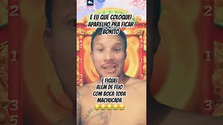 COLOQUEI APARELHO PRA FICAR BONITO E FIQUEI MAS FEIO KKKK #youtubeshorts #shorts #engraçado #memes