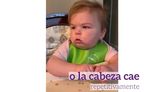 Signs of Infantile Spasms (Spanish)