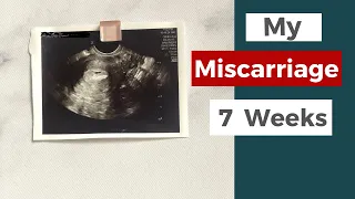 My Early Miscarriage | Miscarriage Symptoms