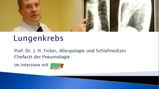 Lungenkrebs: Behandlung im Klinikum Nürnberg