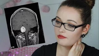 HIRNTUMOR MIT 15! MEINE KRANKHEITSGESCHICHTE l ItsMedea